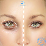 EyePep™- Gel de contorno de ojos