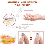 Oveallgo™- Serum reparador de uñas [7 días máxima potencia]